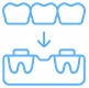 Dental Bridges