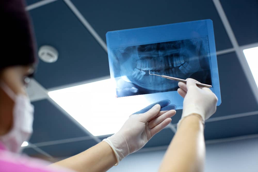 digital dental x rays elgin