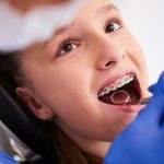 Debunking Common Myths About Orthodontic Treatment
