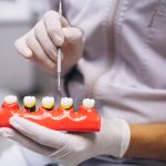 can i get dental implants with a weakened immune system