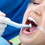how periodontal therapy can reverse early stage gum disease
